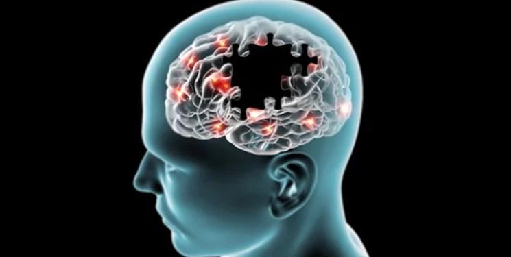تعلیم مغز راهی برای درمان سکته مغزی و پارکینسون