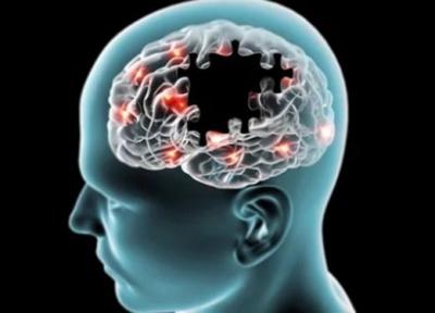 تعلیم مغز راهی برای درمان سکته مغزی و پارکینسون